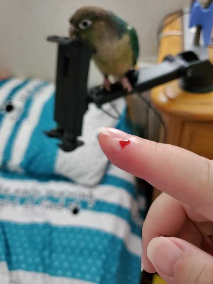 手指被鸚鵡咬出血